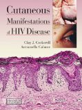 CUTANEOUS MANIFESTATIONS OF HIV DISEASE