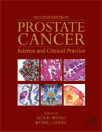 Image of the book cover for 'Prostate Cancer'