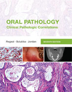 Image of the book cover for 'ORAL PATHOLOGY: CLINICAL PATHOLOGIC CORRELATIONS'