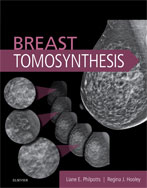 Image of the book cover for 'Breast Tomosynthesis'