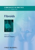 Image of the book cover for 'Fibroids'