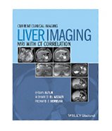 Image of the book cover for 'Liver Imaging'