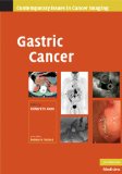 Image of the book cover for 'Gastric Cancer'