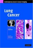 Image of the book cover for 'Lung Cancer'