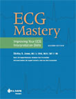 Image of the book cover for 'ECG Mastery'