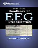Image of the book cover for 'Handbook of EEG Interpretation'