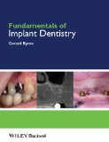 Image of the book cover for 'Fundamentals of Implant Dentistry'