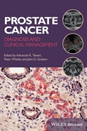 Image of the book cover for 'Prostate Cancer'