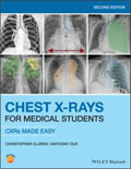 Image of the book cover for 'Chest X-Rays for Medical Students'