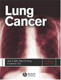 Image of the book cover for 'Lung Cancer'