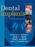 Image of the book cover for 'Dental Implants'