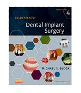 Image of the book cover for 'Color Atlas of Dental Implant Surgery'