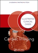 Image of the book cover for 'Cardiac Imaging'