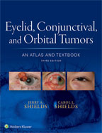 Image of the book cover for 'Eyelid, Conjunctival, and Orbital Tumors'