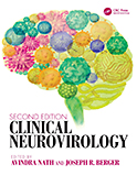 Image of the book cover for 'Clinical Neurovirology'