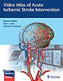 Image of the book cover for 'Video Atlas of Acute Ischemic Stroke Intervention'