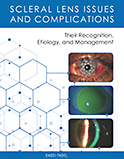 Image of the book cover for 'Scleral Lens Issues and Complications'