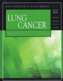 Image of the book cover for 'Lung Cancer'