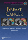 Image of the book cover for 'Breast Cancer'