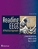 Image of the book cover for 'Reading EEGs'