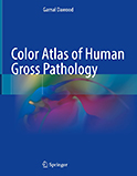 Image of the book cover for 'Color Atlas of Human Gross Pathology'