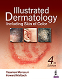Image of the book cover for 'Illustrated Dermatology'