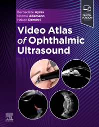 Image of the book cover for 'Video Atlas of Ophthalmic Ultrasound'