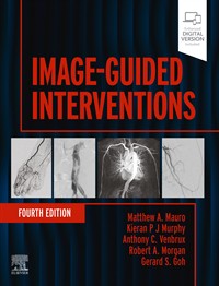 Image of the book cover for 'Image-Guided Interventions'