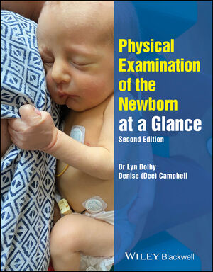 Image of the book cover for 'Physical Examination of the Newborn at a Glance'