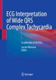 Image of the book cover for 'ECG Interpretation of Wide QRS Complex Tachycardia'